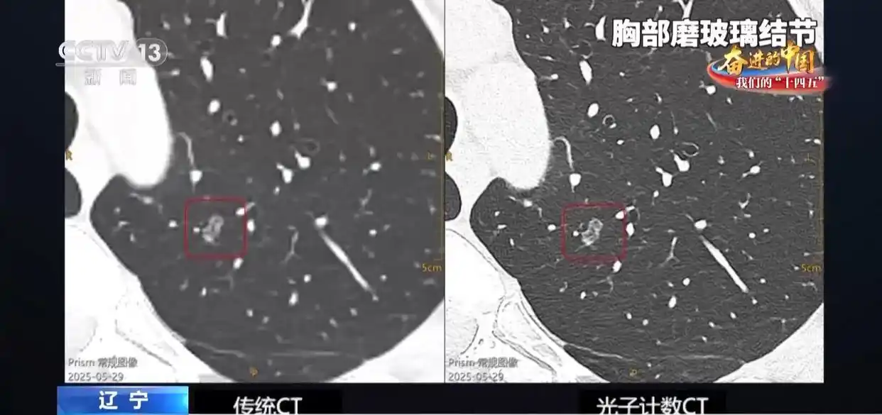 从“跟跑”到“领跑” 国产医疗装备“利器”层出