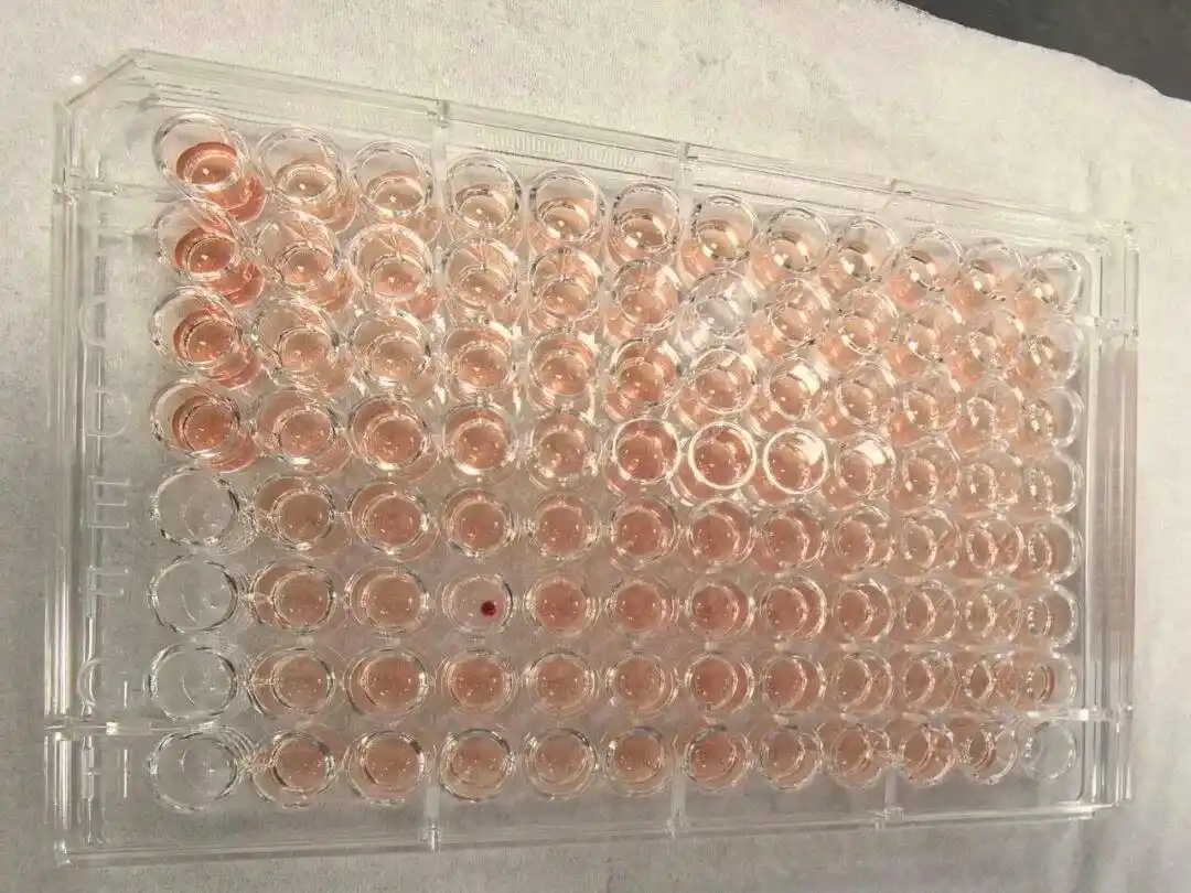 首例！广东顺德发现一例“钻石血”，比“熊猫血”罕见百倍